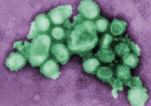 :    H1N1 