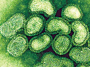      H1N1  