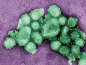    ,    A/H1N1