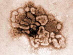   A/H1N1 -     