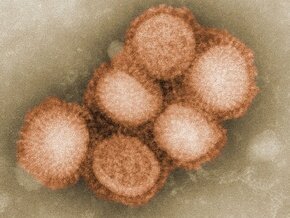    H1N1   100 